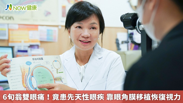 6旬翁雙眼痛！竟患先天性眼疾 靠眼角膜移植恢復視力