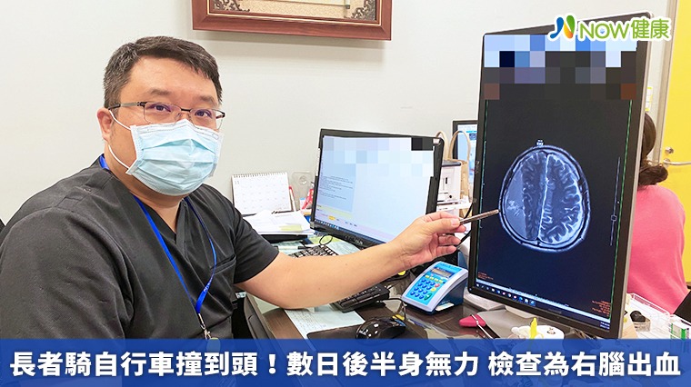 長者騎自行車撞到頭!數日後半身無力 檢查為右腦出血 長者騎自行車撞到頭!數日後半身無力 檢查為右腦出血