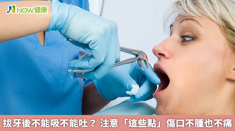 拔牙後不能吸不能吐? 注意「這些點」傷口不腫也不痛 拔牙後不能吸不能吐? 注意「這些點」傷口不腫也不痛