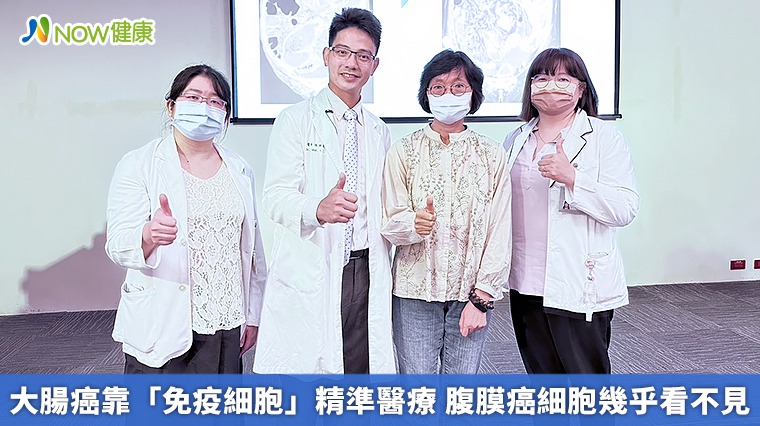 大腸癌靠「免疫細胞」精準醫療 腹膜癌細胞幾乎看不見 大腸癌靠「免疫細胞」精準醫療 腹膜癌細胞幾乎看不見