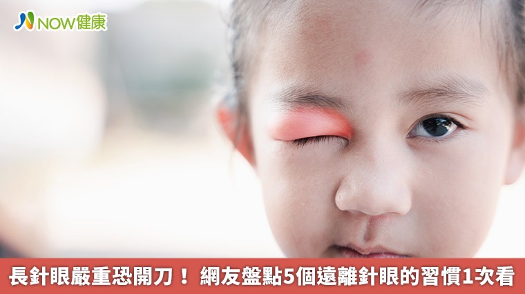 長針眼嚴重恐開刀! 網友盤點5個遠離針眼好習慣1次看 長針眼嚴重恐開刀! 網友盤點5個遠離針眼好習慣1次看