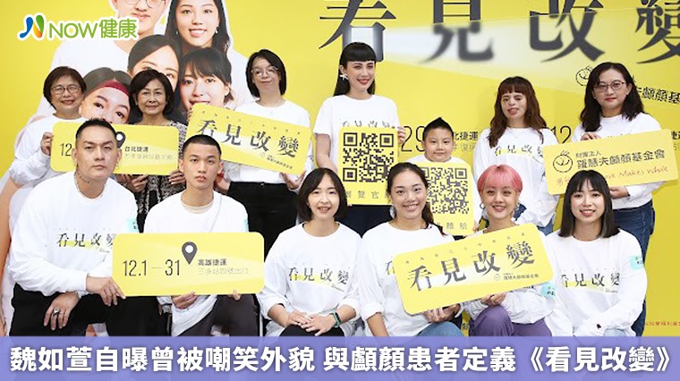 魏如萱自曝曾被嘲笑外貌 與顱顏患者定義《看見改變》 魏如萱自曝曾被嘲笑外貌 與顱顏患者定義《看見改變》