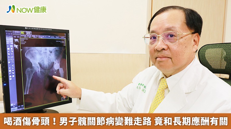 喝酒傷骨頭!男子髖關節病變難走路 竟和長期應酬有關 喝酒傷骨頭!男子髖關節病變難走路 竟和長期應酬有關