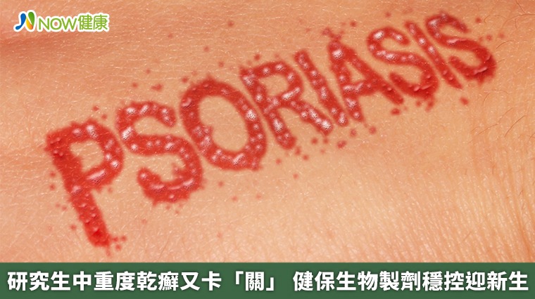 研究生中重度乾癬又卡「關」 健保生物製劑穩控迎新生 研究生中重度乾癬又卡「關」 健保生物製劑穩控迎新生