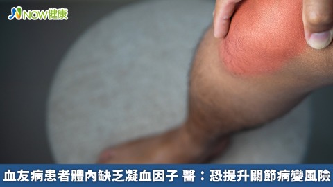 血友病患者體內缺乏凝血因子 醫：恐提升關節病變風險