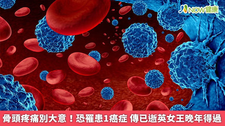 骨頭疼痛別大意!恐罹患1癌症 傳已逝英女王晚年得過 骨頭疼痛別大意!恐罹患1癌症 傳已逝英女王晚年得過