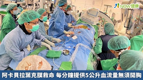 阿卡貝拉葉克膜救命 每分鐘提供5公升血流量無須開胸