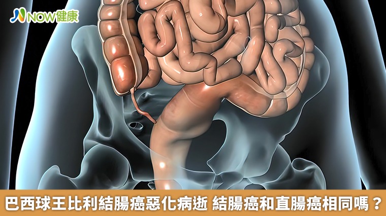 巴西球王比利結腸癌惡化病逝 結腸癌和直腸癌相同嗎? 巴西球王比利結腸癌惡化病逝 結腸癌和直腸癌相同嗎?