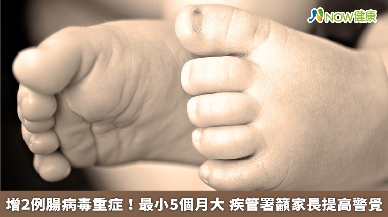 增2例腸病毒重症 5個月大嬰兒染病！防腸病毒很簡單