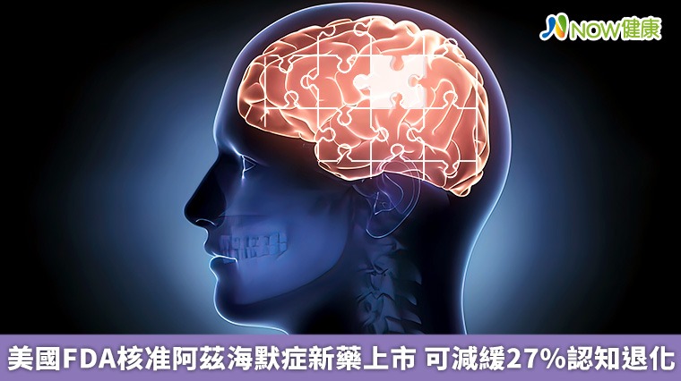 美國FDA核准阿茲海默症新藥上市 可減緩27%認知退化 美國FDA核准阿茲海默症新藥上市 可減緩27%認知退化