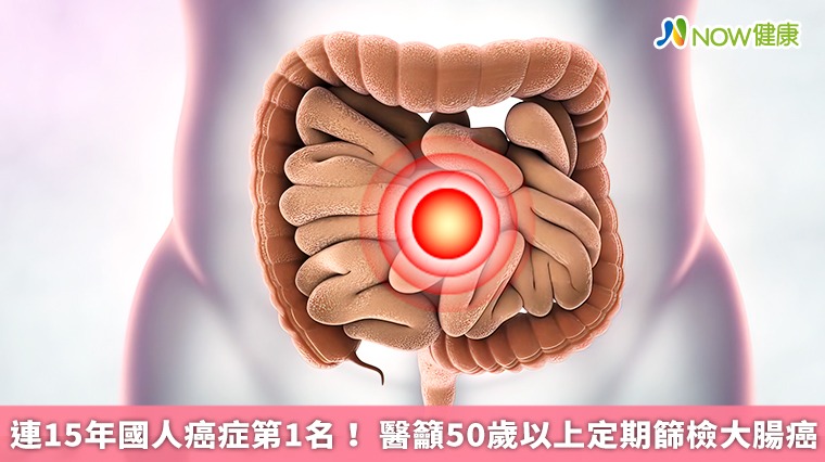 連15年國人癌症第1名! 醫籲50歲以上定期篩檢大腸癌 連15年國人癌症第1名! 醫籲50歲以上定期篩檢大腸癌