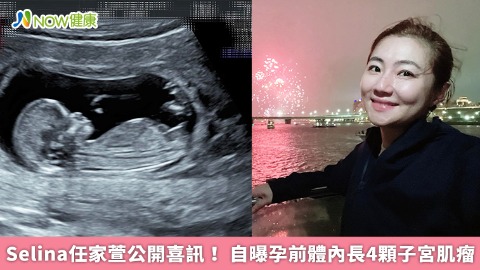 Selina任家萱公開喜訊！ 自曝孕前體內長4顆子宮肌瘤