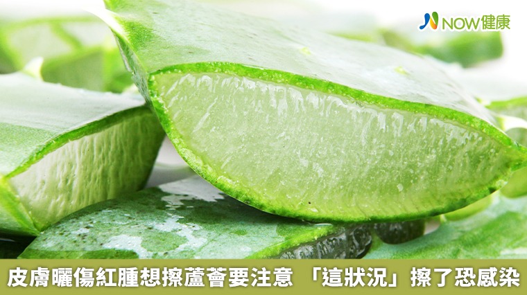 皮膚曬傷紅腫想擦蘆薈要注意 「這狀況」擦了恐感染 皮膚曬傷紅腫想擦蘆薈要注意 「這狀況」擦了恐感染
