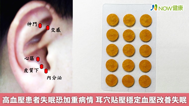 高血壓患者失眠恐加重病情 耳穴貼壓穩定血壓改善失眠 高血壓患者失眠恐加重病情 耳穴貼壓穩定血壓改善失眠