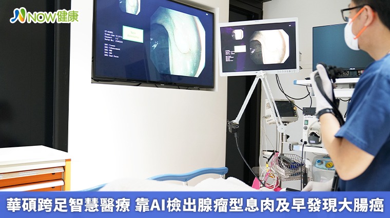 華碩跨足智慧醫療 靠AI檢出腺瘤型息肉及早發現大腸癌 華碩跨足智慧醫療 靠AI檢出腺瘤型息肉及早發現大腸癌