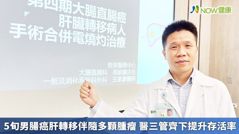 5旬男腸癌肝轉移伴隨多顆腫瘤 醫三管齊下提升存活率 5旬男腸癌肝轉移伴隨多顆腫瘤 醫三管齊下提升存活率