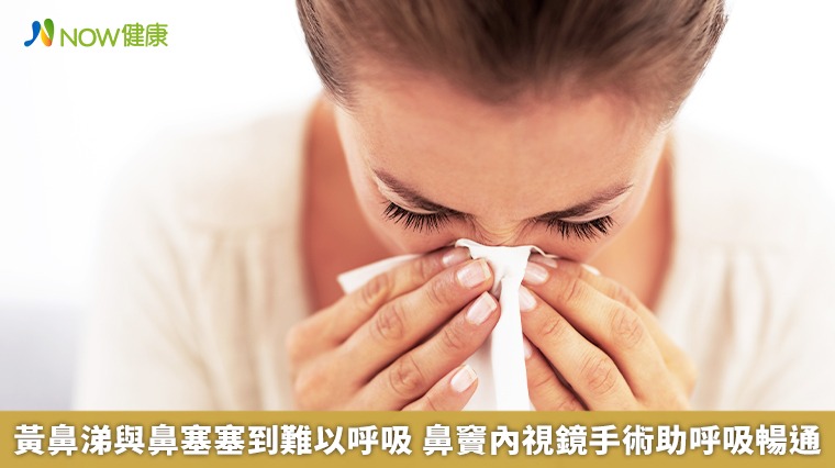 黃鼻涕與鼻塞塞到難以呼吸 鼻竇內視鏡手術助呼吸暢通 黃鼻涕與鼻塞塞到難以呼吸 鼻竇內視鏡手術助呼吸暢通