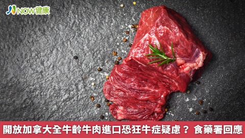 開放加拿大全牛齡牛肉進口恐狂牛症疑慮？ 食藥署回應