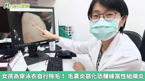 女孩為穿泳衣自行除毛！ 毛囊炎惡化恐釀蜂窩性組織炎