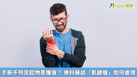 手腕不明突起物是腫瘤？ 骨科醫談「肌腱瘤」如何處理