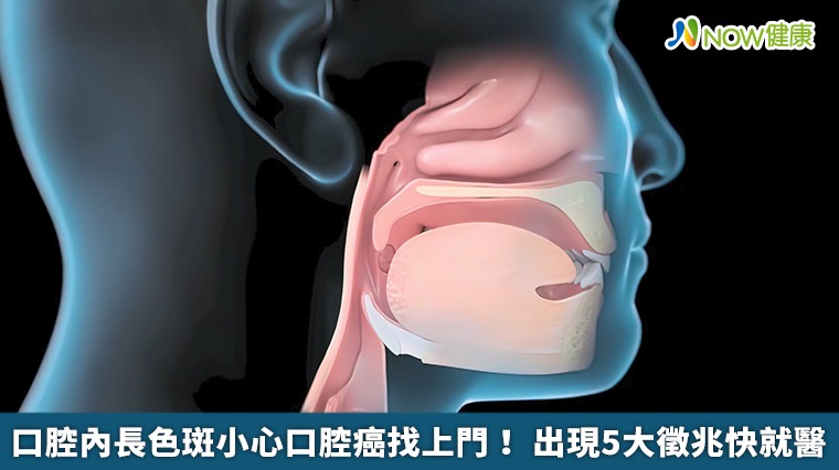 口腔內長色斑小心口腔癌找上門! 出現5大徵兆快就醫 口腔內長色斑小心口腔癌找上門! 出現5大徵兆快就醫