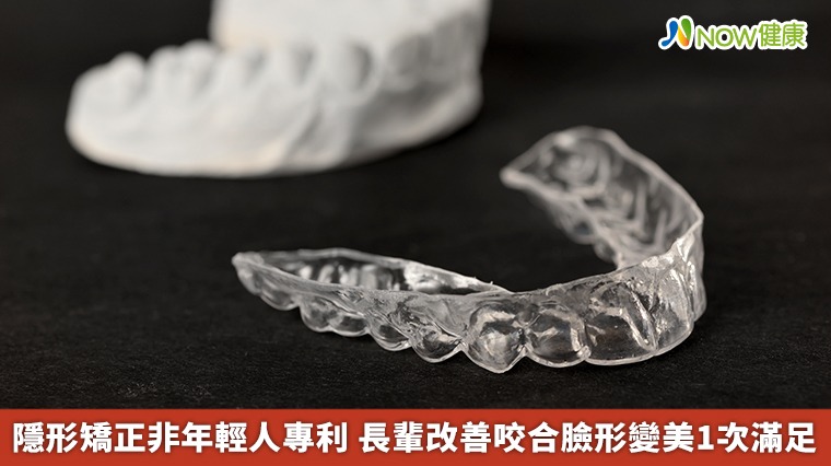 隱形矯正非年輕人專利 長輩改善咬合臉形變美1次滿足 隱形矯正非年輕人專利 長輩改善咬合臉形變美1次滿足