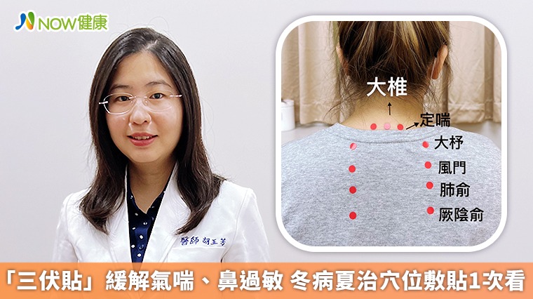 「三伏貼」緩解氣喘、鼻過敏 冬病夏治穴位敷貼1次看 「三伏貼」緩解氣喘、鼻過敏 冬病夏治穴位敷貼1次看