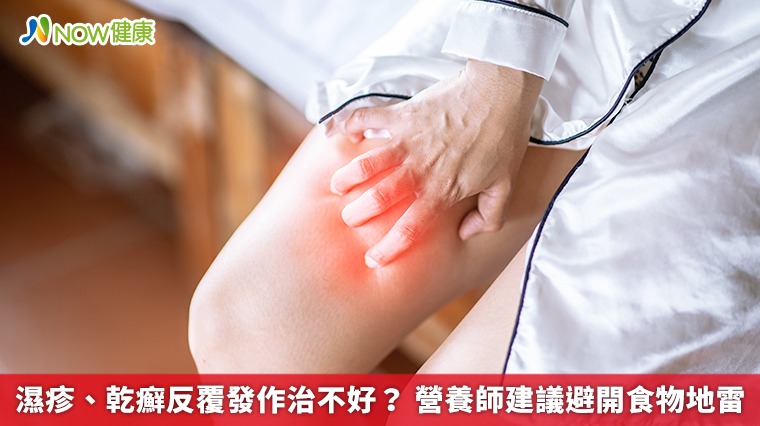 濕疹、乾癬反覆發作治不好? 營養師建議避開食物地雷 濕疹、乾癬反覆發作治不好? 營養師建議避開食物地雷