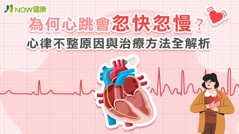 為何心跳會忽快忽慢？ 心律不整原因與治療方法全解析