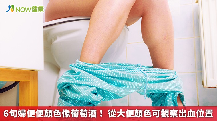 6旬婦便便顏色像葡萄酒! 從大便顏色可觀察出血位置 6旬婦便便顏色像葡萄酒! 從大便顏色可觀察出血位置