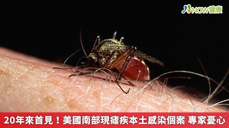 20年來首見!美國南部現瘧疾本土感染個案 專家憂心 20年來首見!美國南部現瘧疾本土感染個案 專家憂心