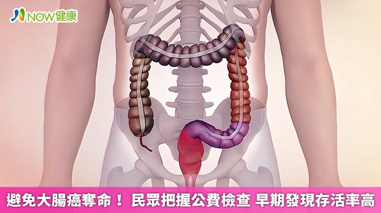 避免大腸癌奪命!民眾把握公費檢查 早期發現存活率高 避免大腸癌奪命!民眾把握公費檢查 早期發現存活率高