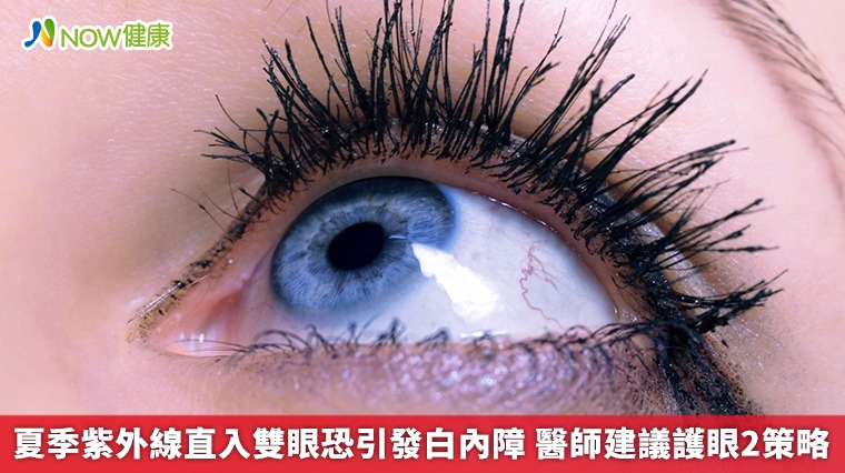 夏季紫外線直入雙眼恐引發白內障 醫師建議護眼2策略 夏季紫外線直入雙眼恐引發白內障 醫師建議護眼2策略