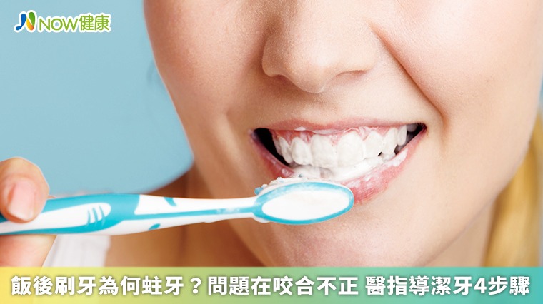 飯後刷牙為何蛀牙?問題在咬合不正 醫指導潔牙4步驟 飯後刷牙為何蛀牙?問題在咬合不正 醫指導潔牙4步驟