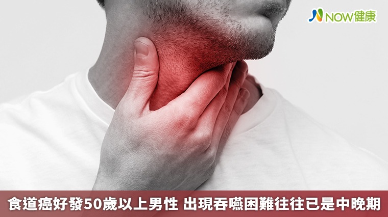 食道癌好發50歲以上男性 出現吞嚥困難往往已是中晚期 食道癌好發50歲以上男性 出現吞嚥困難往往已是中晚期