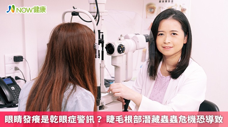 眼睛發癢是乾眼症警訊? 睫毛根部潛藏蟲蟲危機恐導致 眼睛發癢是乾眼症警訊? 睫毛根部潛藏蟲蟲危機恐導致