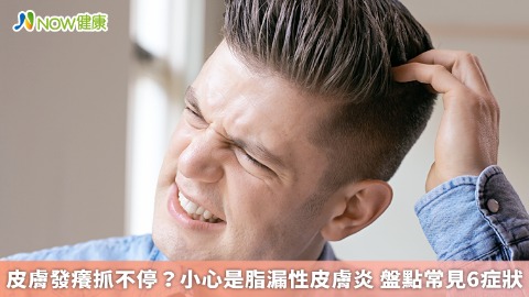 皮膚發癢抓不停？小心是脂漏性皮膚炎 盤點常見6症狀