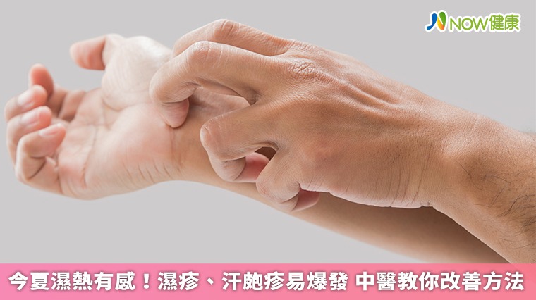 今夏濕熱有感!濕疹、汗皰疹易爆發 中醫教你改善方法 今夏濕熱有感!濕疹、汗皰疹易爆發 中醫教你改善方法
