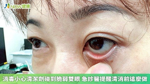 消毒小心清潔劑碰到脆弱雙眼 急診醫提醒清消前這麼做