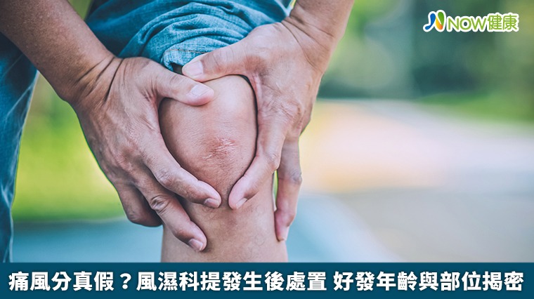 痛風分真假?風濕科提發生後處置 好發年齡與部位揭密 痛風分真假?風濕科提發生後處置 好發年齡與部位揭密