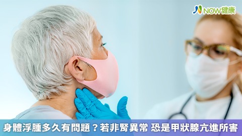 身體浮腫多久有問題？若非腎異常 恐是甲狀腺亢進所害