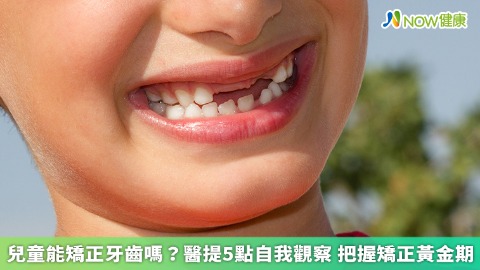 兒童能矯正牙齒嗎？醫提5點自我觀察 把握矯正黃金期