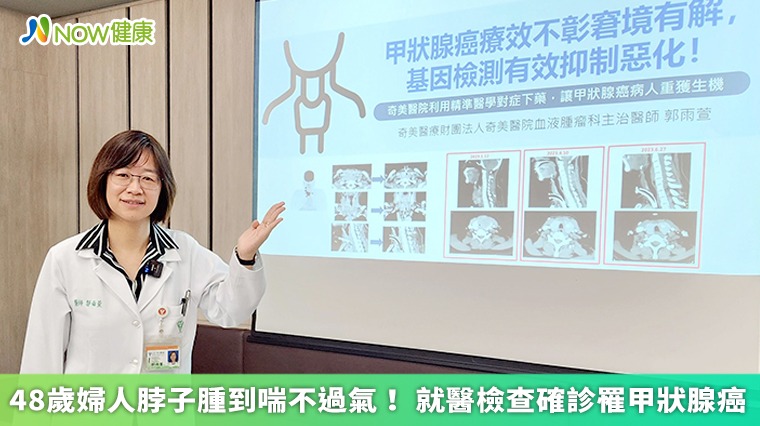 48歲婦人脖子腫到喘不過氣！ 就醫檢查確診罹甲狀腺癌