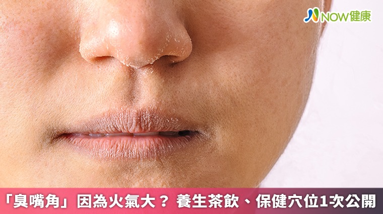 「臭嘴角」是體內火氣大?中醫對症緩解口角炎,養生茶飲、保健穴位1次公開 「臭嘴角」是體內火氣大?中醫對症緩解口角炎,養生茶飲、保健穴位1次公開
