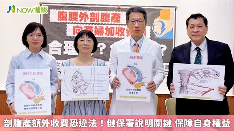 剖腹產額外收費恐違法!健保署說明關鍵 保障自身權益 剖腹產額外收費恐違法!健保署說明關鍵 保障自身權益