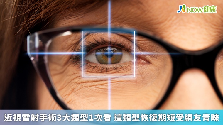 近視雷射手術3大類型1次看 這類型恢復期短受網友青睞 近視雷射手術3大類型1次看 這類型恢復期短受網友青睞