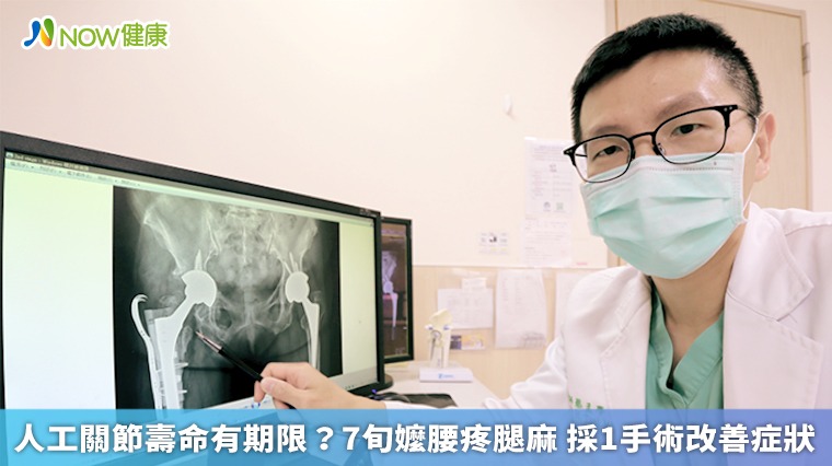 人工關節壽命有期限？7旬嬤腰疼腿麻 採1手術改善症狀