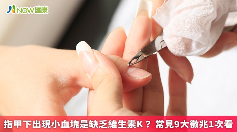 指甲下出現小血塊是缺乏維生素K? 常見9大徵兆1次看 指甲下出現小血塊是缺乏維生素K? 常見9大徵兆1次看