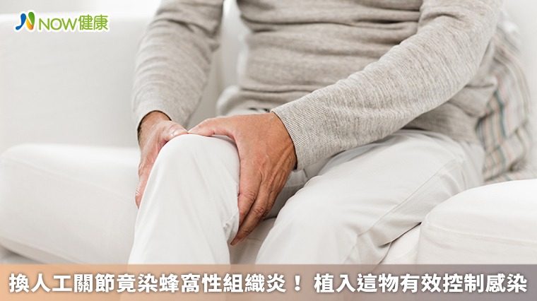 換人工關節竟染蜂窩性組織炎! 植入這物有效控制感染 換人工關節竟染蜂窩性組織炎! 植入這物有效控制感染