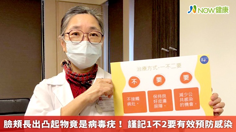 臉頰長出凸起物竟是病毒疣！ 謹記1不2要有效預防感染